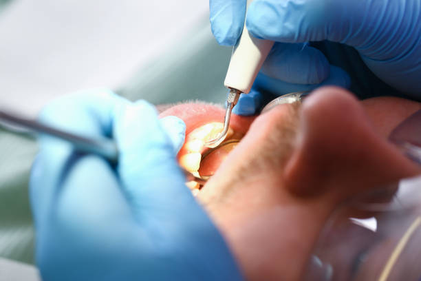 Best Broken Tooth Emergency  in Port Neches, TX